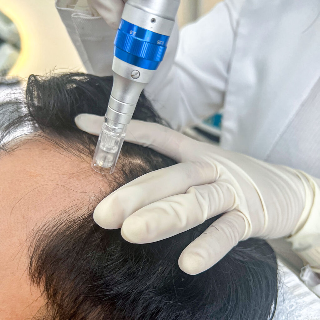 Services - Exosome Hair