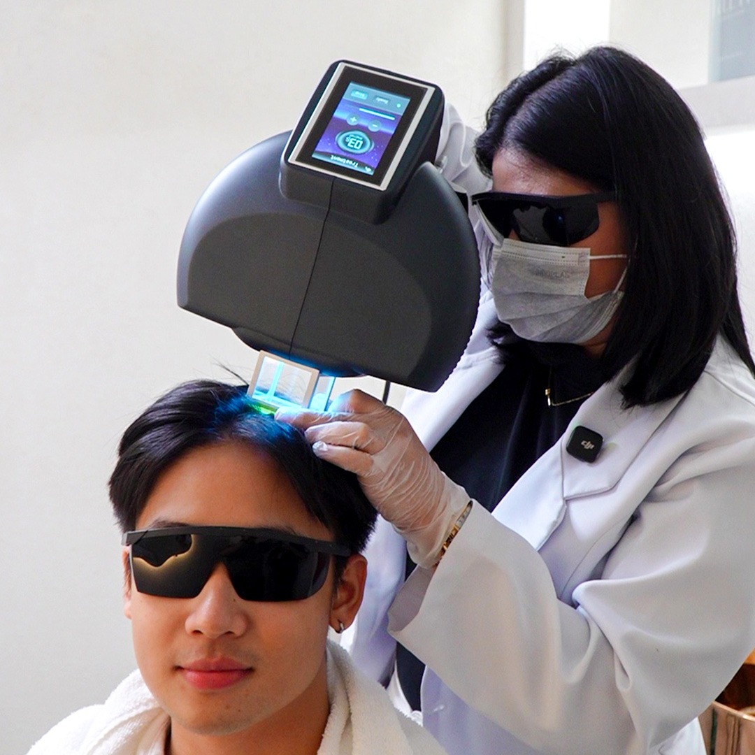 Excimer Laser Scalp Psoriasis Treatment - Healthy Scalp