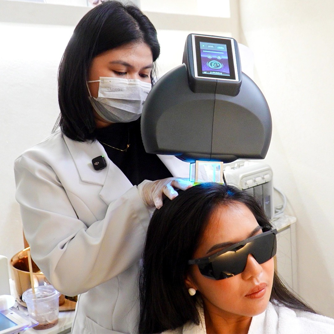 Excimer Laser Scalp Psoriasis Treatment - Healthy Scalp